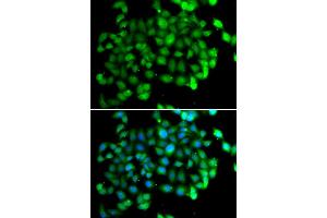 Immunofluorescence analysis of U2OS cells using APOBEC3C antibody (ABIN5973484).