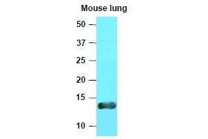 Western Blotting (WB) image for anti-Vesicle-Associated Membrane Protein 3 (VAMP3) (AA 1-77), (N-Term) antibody (ABIN336092) (VAMP3 antibody  (N-Term))