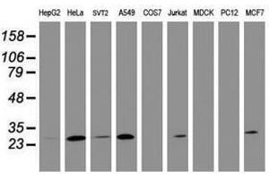 Image no. 2 for anti-B-Cell CLL/lymphoma 10 (BCL10) antibody (ABIN1496850) (BCL10 antibody)