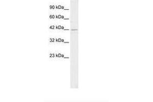 Image no. 2 for anti-Heat Shock Transcription Factor 2 Binding Protein (HSF2BP) (N-Term) antibody (ABIN202272) (HSF2BP antibody  (N-Term))