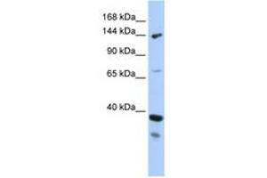 DHX37 anticorps  (AA 71-120)