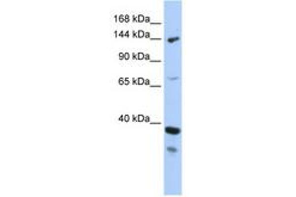 DHX37 anticorps  (AA 71-120)