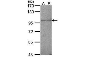 WB Image Sample (30 ug of whole cell lysate) A: Hela B: NT2D1 7. (Importin 9 antibody  (C-Term))