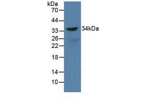 Detection of Recombinant SOX18, Rat using Polyclonal Antibody to Sex Determining Region Y Box Protein 18 (SOX18) (SOX18 antibody  (AA 153-377))