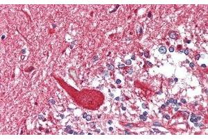 Immunohistochemistry (IHC) image for anti-Hexosaminidase B (Beta Polypeptide) (HEXB) (AA 122-311) antibody (ABIN7438553)