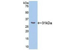 Detection of Recombinant RORa, Human using Polyclonal Antibody to RAR Related Orphan Receptor Alpha (RORa) (RORA antibody  (AA 164-401))