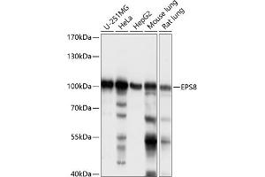 Western blot analysis of extracts of various cell lines, using EPS8 antibody (ABIN7266992) at 1:1000 dilution.