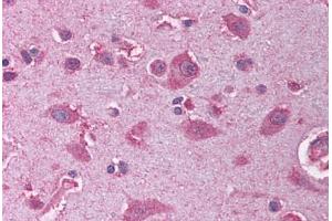 Human Brain, Cortex (formalin-fixed, paraffin-embedded) stained with OLIG2 antibody ABIN214131 at 5 ug/ml followed by biotinylated goat anti-rabbit IgG secondary antibody ABIN481713, alkaline phosphatase-streptavidin and chromogen. (OLIG2 antibody  (AA 236-285))