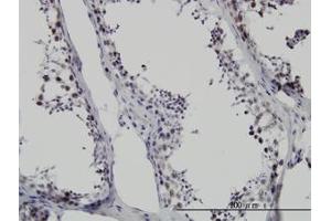 Image no. 1 for anti-Survival Motor Neuron Domain Containing 1 (SMNDC1) (AA 1-239) antibody (ABIN599128) (SMNDC1 antibody  (AA 1-239))
