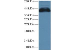 Detection of UCP4 in Mouse Cerebrum lysate using Polyclonal Antibody to Uncoupling Protein 4, Mitochondrial (UCP4) (SLC25A27 antibody  (AA 21-317))