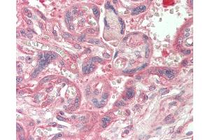 Human Placenta: Formalin-Fixed, Paraffin-Embedded (FFPE). (CAD antibody  (N-Term))