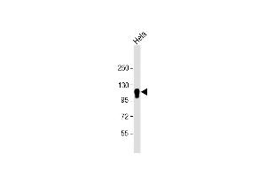 Anti-CYLD Antibody at 1:4000 dilution + Hela whole cell lysate Lysates/proteins at 20 μg per lane. (CYLD antibody  (AA 305-582))