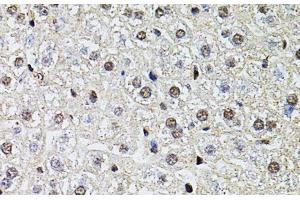 Immunohistochemistry of paraffin-embedded Mouse liver using POP4 Polyclonal Antibody at dilution of 1:100 (40x lens). (RPP29 antibody)