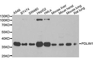Western blot analysis of extracts of various cell lines, using PDLIM1 antibody. (PDLIM1 antibody)