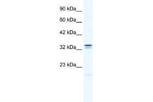 WB Suggested Anti-ANKZF1 Antibody Titration:  0. (ANKZF1 antibody  (N-Term))