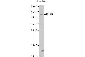 Western blot analysis of extracts of rat liver, using KLRB1 antibody. (CD161 antibody)