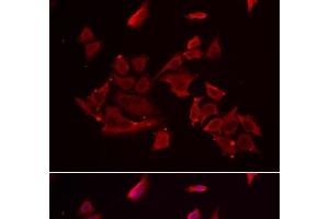Immunofluorescence analysis of MCF-7 cells using RARRES2 Polyclonal Antibody (Chemerin antibody)