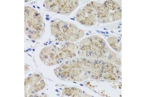 Immunohistochemistry of paraffin-embedded human stomach using MTERFD3 antibody. (MTERFD3 antibody  (AA 1-250))