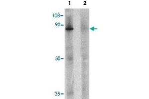 Western blot analysis of human small intestine tissue lysate with ZFX polyclonal antibody  at 1 ug/mL in (1) the absence and (2) the presence of blocking peptide. (ZFX antibody  (C-Term))