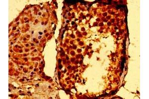 Immunohistochemistry of paraffin-embedded human testis tissue using ABIN7169686 at dilution of 1: 100 (STAT5B antibody  (AA 40-280))