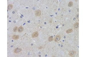 Immunohistochemistry analysis of paraffin-embedded rat brain using DLG4 Polyclonal Antibody at dilution of 1:100. (DLG4 antibody)