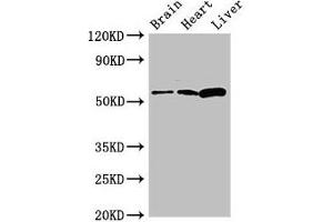 Western Blot Positive WB detected in: Mouse brain tissue, Rat heart tissue, Rat liver tissue All lanes: CPEB2 antibody at 2. (CPEB2 antibody  (AA 167-308))