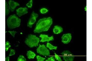 Image no. 4 for anti-Cell Division Cycle 37 Homolog (S. Cerevisiae) (CDC37) (AA 1-379) antibody (ABIN599169) (CDC37 antibody  (AA 1-379))