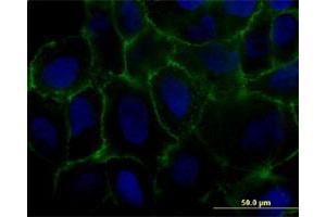 Immunofluorescence of monoclonal antibody to MCAM on U-2 OS cell. (MCAM antibody  (AA 1-646))