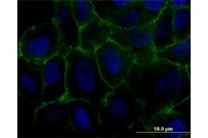 Immunofluorescence of monoclonal antibody to MCAM on U-2 OS cell. (MCAM antibody  (AA 1-646))