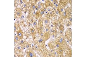 Immunohistochemistry of paraffin-embedded human liver injury using RPN1 antibody.