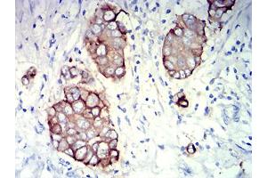 Immunohistochemistry (IHC) image for anti-Mucin 1 (MUC1) (AA 66-175) antibody (ABIN5611324)