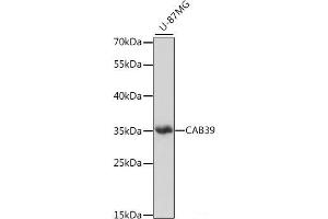 Western blot analysis of extracts of U-87MG cells using CAB39 Polyclonal Antibody at dilution of 1:1000. (CAB39 antibody)