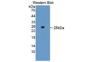 Detection of Recombinant GH, Canine using Polyclonal Antibody to Growth Hormone (GH) (Growth Hormone 1 antibody  (AA 27-216))