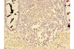 Immunohistochemistry of paraffin-embedded human colon tissue using ABIN7148068 at dilution of 1:100 (CCDC112 antibody  (AA 201-446))