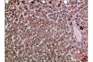 Immunohistochemical analysis of paraffin-embedded human-liver, antibody was diluted at 1:200 (CXCL12 antibody  (AA 31-80))