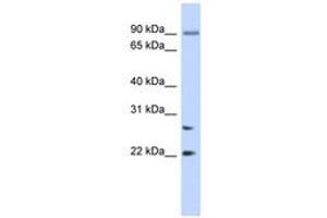 JOSD2 antibody  (AA 35-84)
