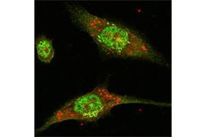 Confocal immunofluorescence analysis of Eca-109 cells using ERK2 mouse mAb (green). (ERK2 antibody)