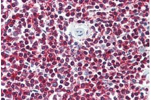 Anti-LGR6 antibody  ABIN1049008 IHC staining of human spleen. (LGR6 antibody  (Internal Region))