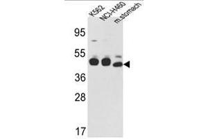 Image no. 1 for anti-Keratin 18 (KRT18) (C-Term) antibody (ABIN452897) (Cytokeratin 18 antibody  (C-Term))