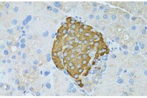Immunohistochemistry of paraffin-embedded Rat pancreas using TEFM Polyclonal Antibody at dilution of 1:100 (40x lens).