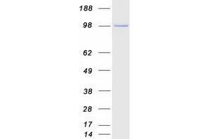 Validation with Western Blot (JAK2 Protein (full length) (Myc-DYKDDDDK Tag))