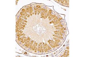 MYL6 antibody