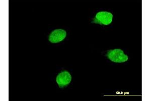 Immunofluorescence of monoclonal antibody to BRD8 on HeLa cell. (BRD8 antibody  (AA 33-128))