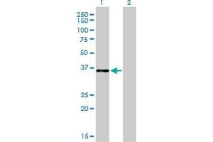 Western Blot analysis of CEBPE expression in transfected 293T cell line by CEBPE monoclonal antibody (M01), clone 7A4. (CEBPE antibody  (AA 1-281))