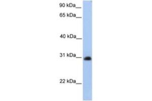 Western Blotting (WB) image for anti-Carbohydrate (N-Acetylgalactosamine 4-0) Sulfotransferase 14 (CHST14) antibody (ABIN2463248) (CHST14 antibody)
