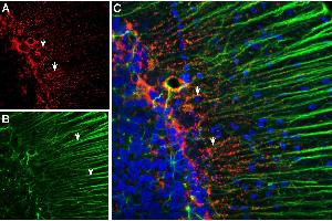 Multiplex staining of Connexin-43 and GFAP in rat cerebellum.