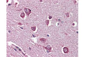 Anti-DPP10 antibody IHC of human brain, cortex. (DPP10 antibody  (Internal Region))