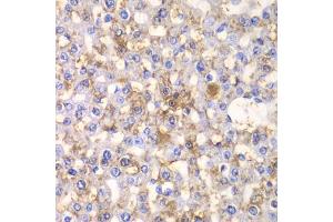 Immunohistochemistry of paraffin-embedded rat liver using HAPLN1 antibody.