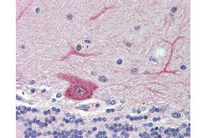 Immunohistochemistry (IHC) image for anti-GABA(A) Receptor-Associated Protein Like 1 (GABARAPL1) (Middle Region) antibody (ABIN2786183) (GABARAPL1 antibody  (Middle Region))