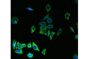 Immunofluorescent analysis of LO2 cells using ABIN7173099 at dilution of 1:100 and Alexa Fluor 488-congugated AffiniPure Goat Anti-Rabbit IgG(H+L) (TMEM176B antibody  (AA 1-64))